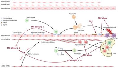 Disease-modifying anti-rheumatic drugs improve the cardiovascular profile in patients with rheumatoid arthritis